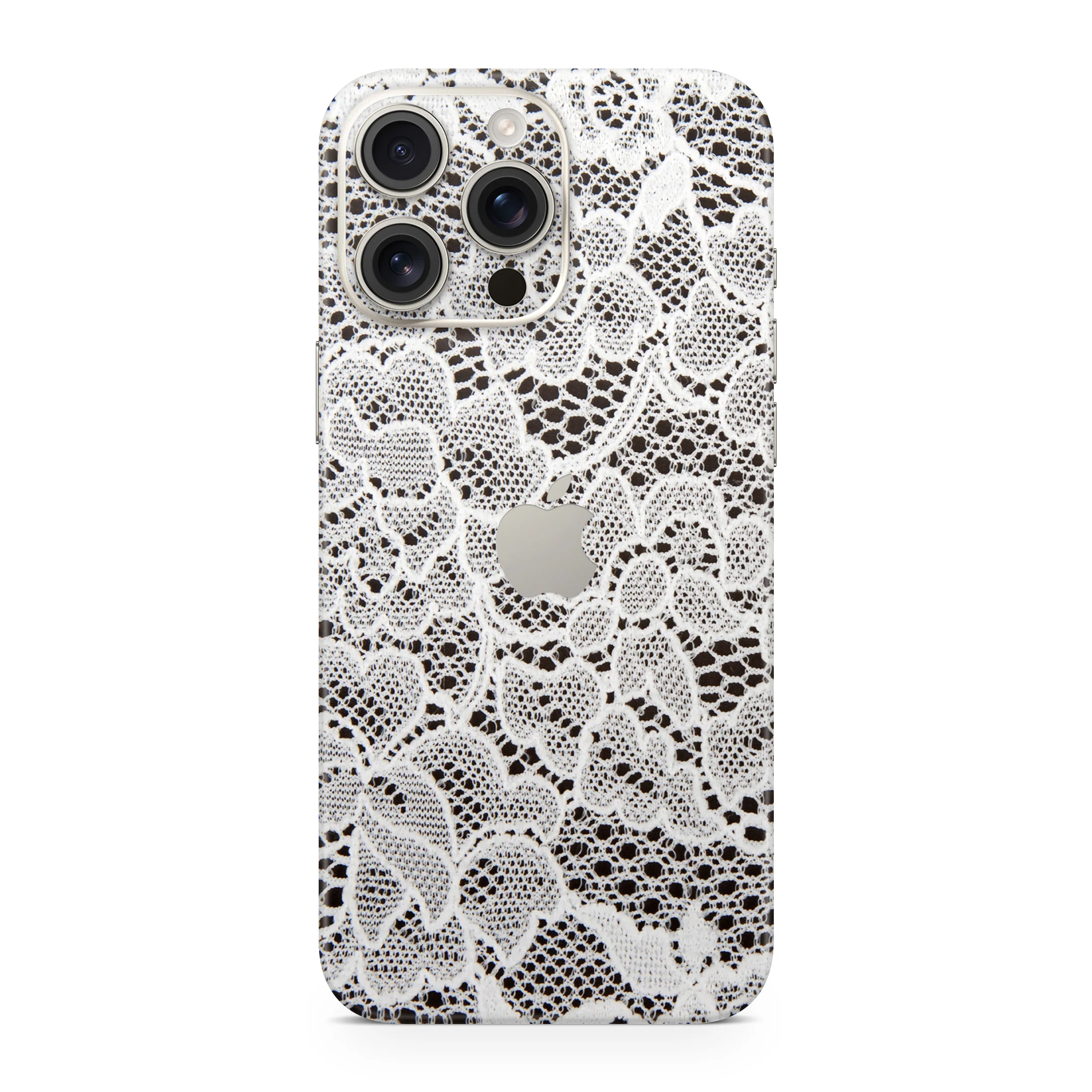 French Lace iPhone Skin + Case - Image 3
