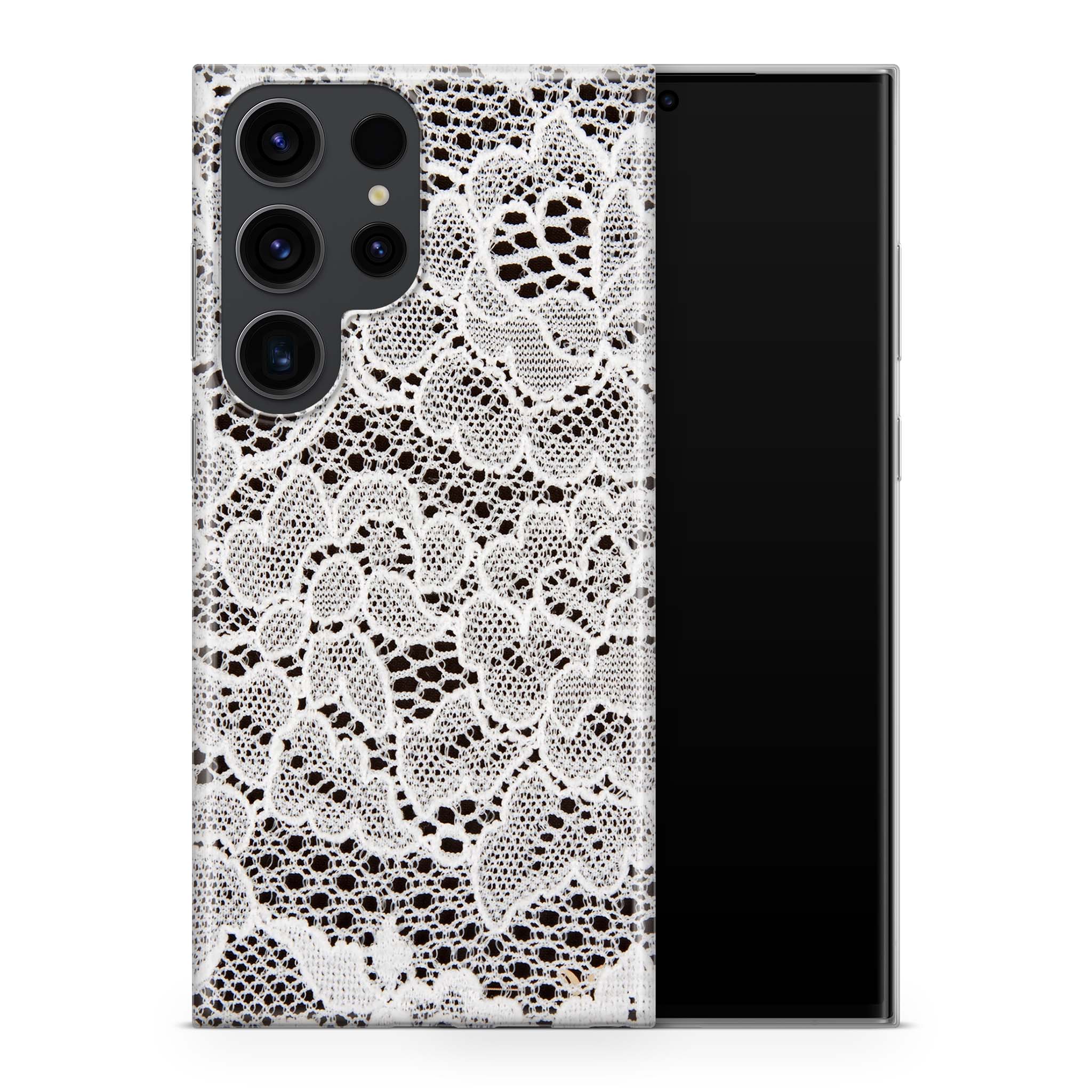 French Lace Samsung Galaxy Skin + Case - Image 3